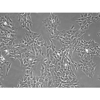 Porcine Retinal Astrocytes (PA-r)- Phase Contrast, 100x.
