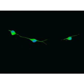 Rat Oligodendrocyte Precursor Cells (ROPC) – Immunostaining for O1, 400x.
