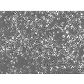 Rat Pulmonary Alveolar Macrophages (RPAMa) - Phase contrast, 100x
