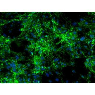 Rat Splenic Fibroblasts - Immunostaining FN 200X