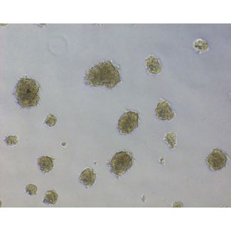 Human Ovarian Fibroblast Spheroids