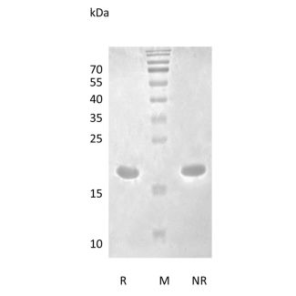 Recombinant Human Interleukin-1 beta