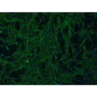 人乳腺成纤维细胞（HMF）- 纤维连接蛋白（Fibronectin）免疫荧光染色，100×
