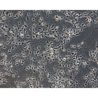 人多能干细胞衍生的多巴胺能神经元，相差显微镜 200X