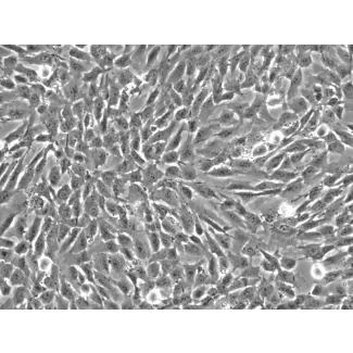 人椎体间充质干细胞（HVMSC）- 相差显微镜，200×
