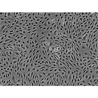 人源子宫内膜微血管内皮细胞（HEMEC）- 相差显微镜，200×