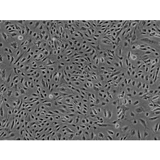 人源子宫肌层微血管内皮细胞（HMMEC）- 相差显微镜，200×