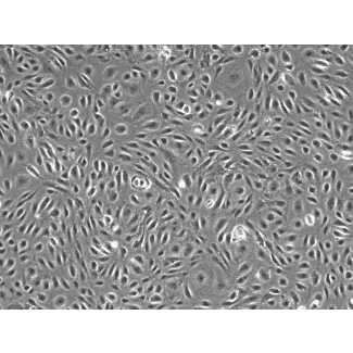人硬脑膜微血管内皮细胞（HDuMEC）- 相差显微镜，100×
