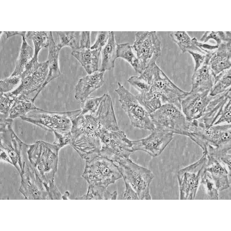 人绒毛滋养层细胞（HVT）- 相差显微镜，400×
