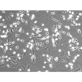 人肝巨噬细胞（HHMa）– 相差显微镜，100倍
