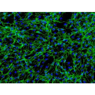 人肠成纤维细胞（HIF）- 纤连蛋白（Fibronectin）免疫荧光染色，200×
