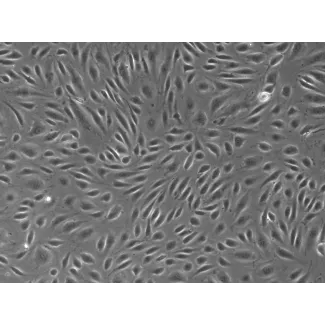 人胎盘血管内皮细胞（HPVEC）- 相差显微镜，100×