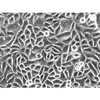 人食管上皮细胞（HEEpiC）- 相差显微镜图像，200×
