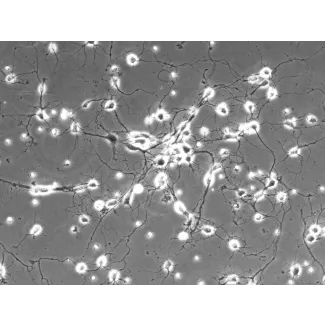 大鼠小脑颗粒细胞（RGC）——相差显微镜图像，200×
