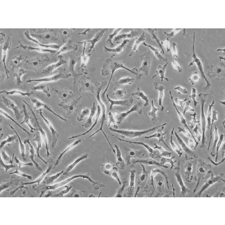 大鼠巨噬细胞（RMa-bm）——相差显微镜下，200×
