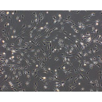 大鼠神经束膜成纤维细胞（RPNF）— 相差显微镜观察，100×放大。