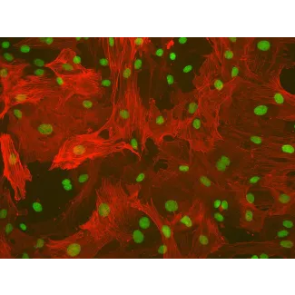 大鼠肝星状细胞（RHSteC）α-SMA 免疫荧光染色，200×
