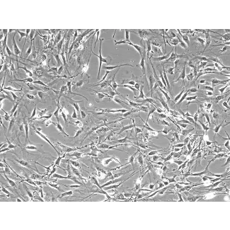 小鼠淋巴成纤维细胞（MLF）——相差显微镜下，100×
