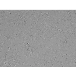 小鼠胚胎成纤维细胞（MEF）——浮雕相差显微镜下，200×

