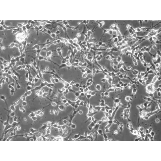 小鼠中缝核神经元（MN-r）– 相差显微镜，200×

