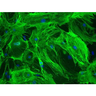 小鼠脑血管周细胞（MBVP）– α-SMA 免疫染色，200×

