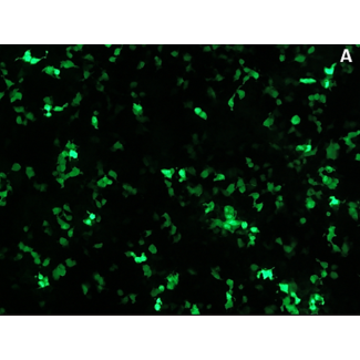 转染极大培养基 - TMM