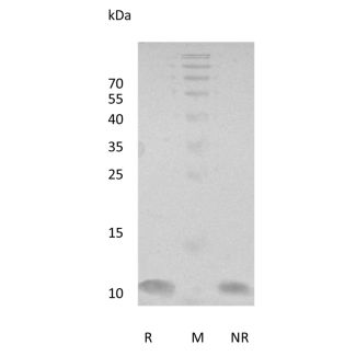 重组人NRG-1（EGF样结构域）Beta 1