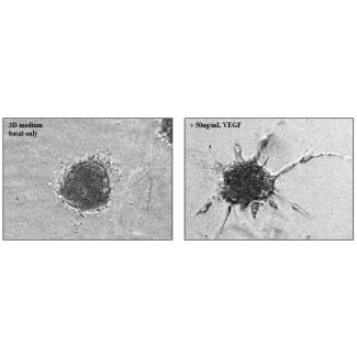 Collagen-embedded HUVEC spheroids at 24 hours post VEGF-stimulation