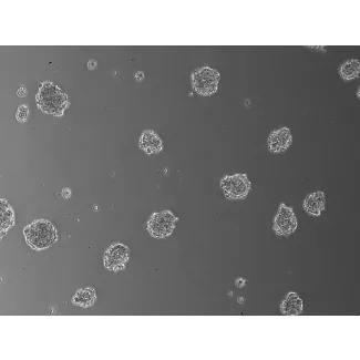 Days 3; 3D Human Blood Brain Barrier Spheroids (At 100X magnification). 