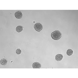 Development of 3D osteoblast spheroid at days 3 (taken at 100x magnification). 