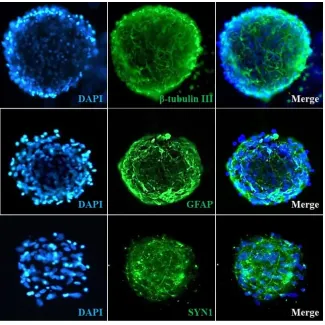 Human Cortical Spheroids at Day 7