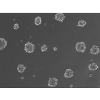 3D hepatic stellate cell spheroids at day 2