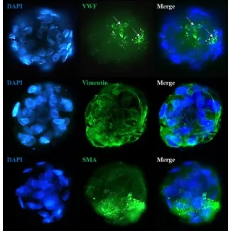 Immunostaining of the co-culture spheroids with the stellate cell markers (Vimentin and Smooth Muscle Actin) and the endothelial cell marker Von Willebrand Factor.