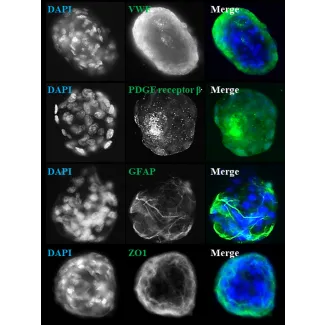 Days 7; IF analysis of rat blood brain barrier spheroids