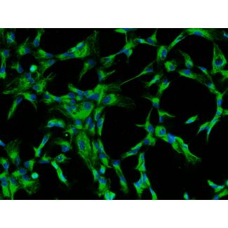 Bovine Lens Epithelial Cells (BLEpiC)-Immunostaining for CK-18, 200X.