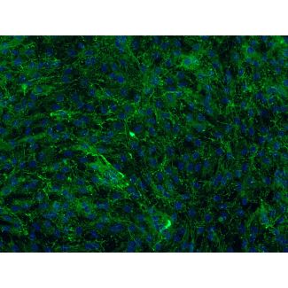 Bovine Meningeal Cells (BMC)-Immunostaining for FN, 200X
