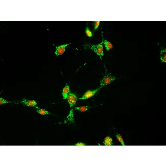 小鼠真皮成纤维细胞（MDF）– 纤维连接蛋白（Fibronectin，FN）免疫染色，400×放大