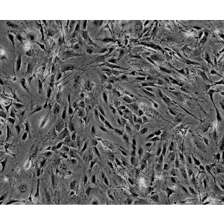 该细胞分离自出生后第8天的 C57BL/6 小鼠坐骨神经组织。MPNF 在第1代（P1）进行冻存，并以冷冻形式交付。每支冻存管体积为 1ml，细胞数量不少于 5 × 10^5 个。