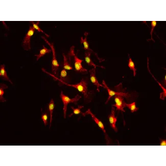 小鼠肝巨噬细胞（MHMa）F4/80 免疫染色，400×

