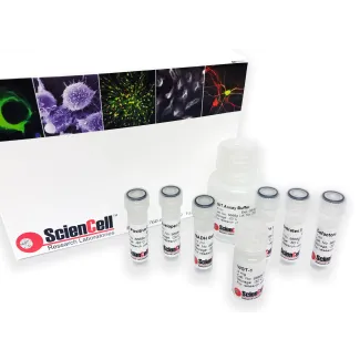 Colorimetric Histone Acetyltransferase Activity Assay