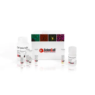 GeneQuery™ HLA-A*02 qPCR 分型检测试剂盒