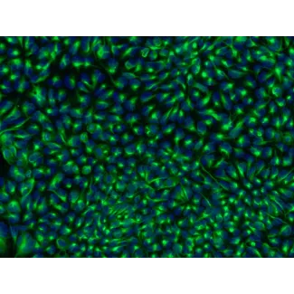HPSC-Derived Neural Stem Cells (H9-NSC) – Immunostaining for Nestin, 200x