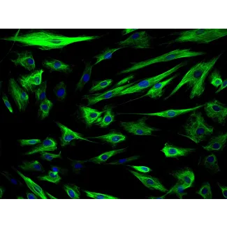 Human Amniotic Epithelial Cells (HAmEpiC) - Immunostaining for CK-18, 200x.
