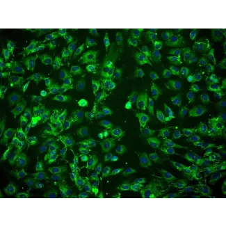 Human Amniotic Mesenchymal Stromal Cells (HAMSC) - Immunostaining for CD105, 200x.
