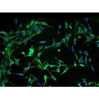 Human Aortic Adventitia Fibroblasts (HAAF) - Immunostaining for Fibronectin, 200x.