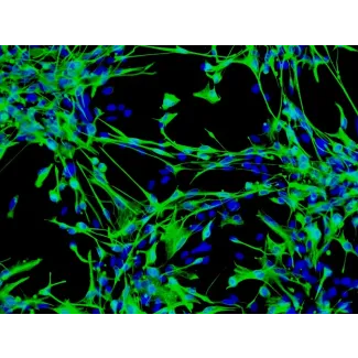 Human Astrocytes-brain stem (HA-bs) - mmunostaining for GFAP, 100x.
