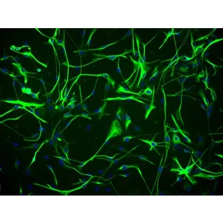 Human Astrocytes-hippocampal (HA-h) - Immunostaining for GFAP, 200x.
