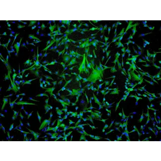 Human Astrocytes-midbrain (HA-mb) - Immunostaining for GFAP, 100x.
