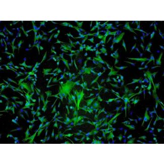 Human Astrocytes-spinal cord (HA-sp) - Immunostaining for GFAP, 100x.
