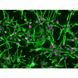 Human Astrocytes (HA) - Immunostaining for GFAP, 200x.
